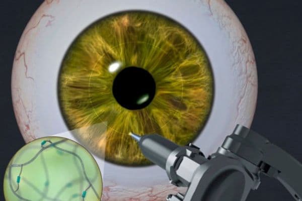 Adhesive gel for corneas