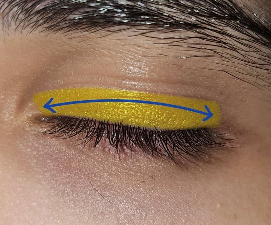 Fig 1B Periocular Image