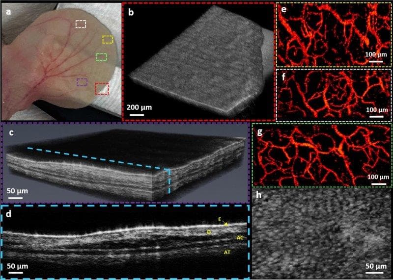 New ophthalmic imaging technique unveiled-pars-mouse-ear-imaging.jpg