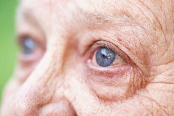 RANZCO launches Kiwi’fied AMD guidelines
