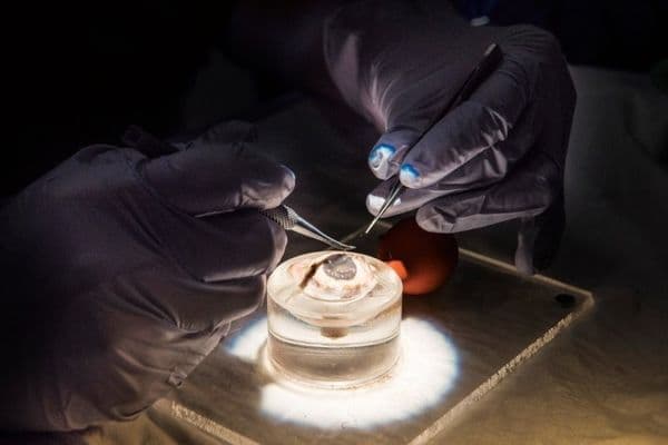 Celebrating the micro-skills ophthalmology needs