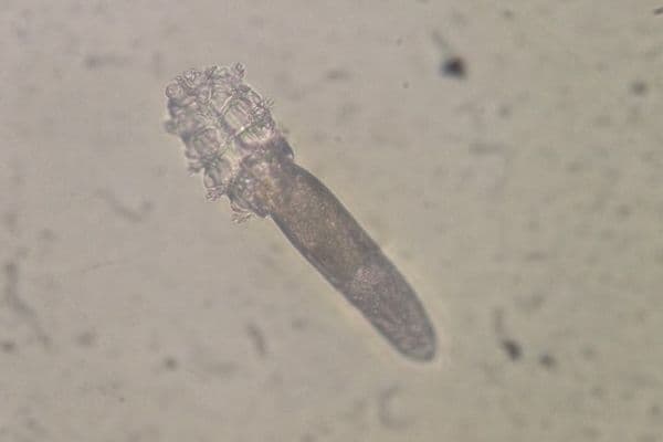 eye on ophtho demodex fig 1