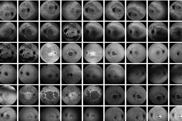 eye2gene online