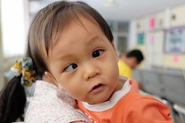 Strabismus linked to mental illness (1)