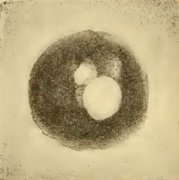 Ophthalmoscopy through the ages-fig-4-retinal-image.jpg