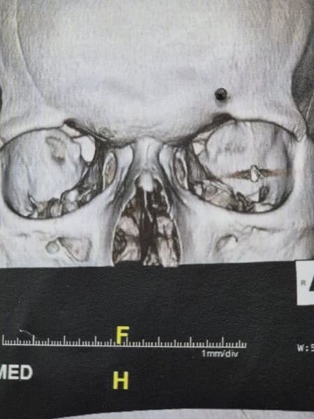 Minhaj's Bullet