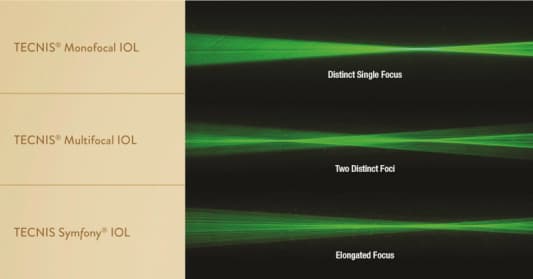 FDA approved IOL first trialled in NZ-fig-1-tecnis-symfony-focal-light-points.jpg
