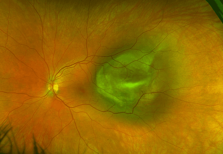 Fig 3 EoO Jun 2026