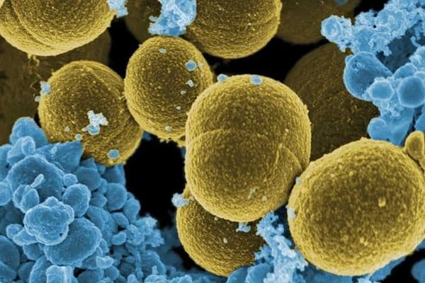 Antibiotic resistance common in eye diseases