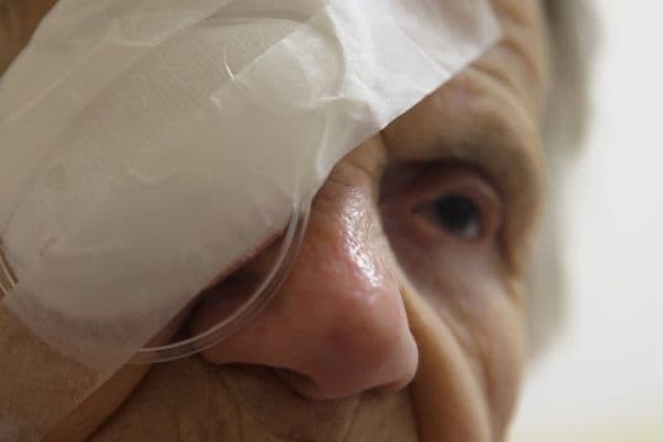 Tackling NZ’s growing cataract backlog