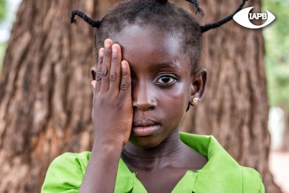 Efforts to reduce preventable blindness fall short