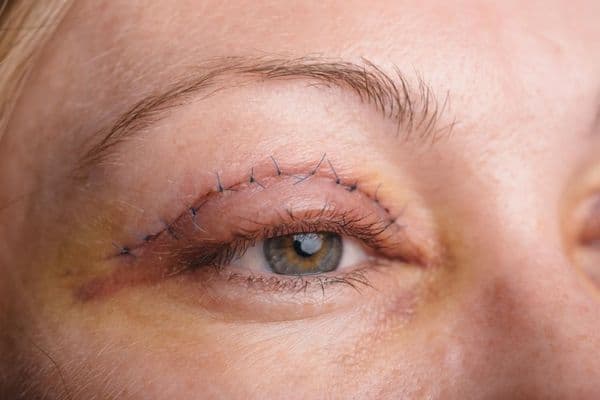 Oculoplastic research review February 2025