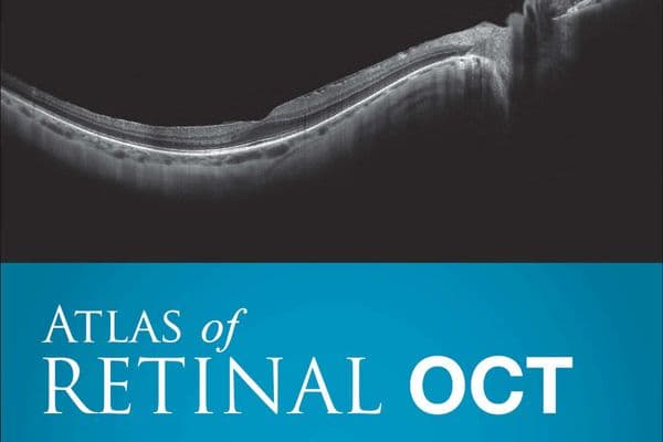 Book review – Atlas of Retinal OCT, 1st edition