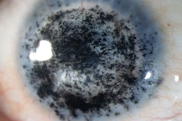 Eye-stonishing: CCLS NZ 2025 photo competition winners