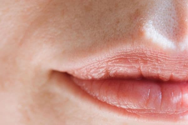 Salivary gland transplant for DED