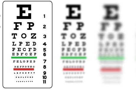 Spectacles to slow myopia?