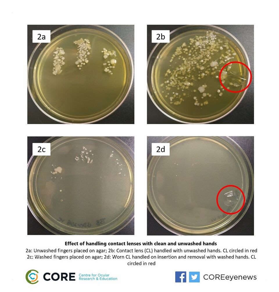 What saliva does to your CLs-clpetri2.jpg