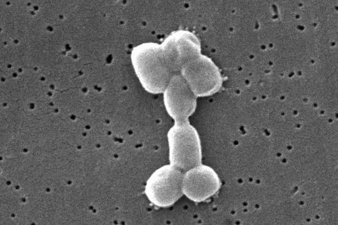Superbug’s Achilles’ heel-acinetobacter-baumannii-sem.jpg