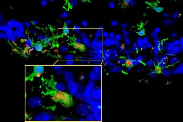 jCell IVT shows promise for RP