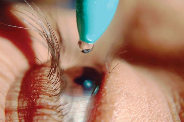 US push for preservative-free drops