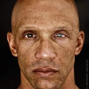 Better solution for eyelid closure-nathan-horner.jpg