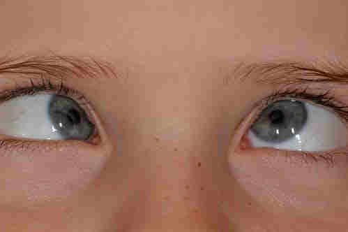 Orthoptists: crossing ophthalmology divides