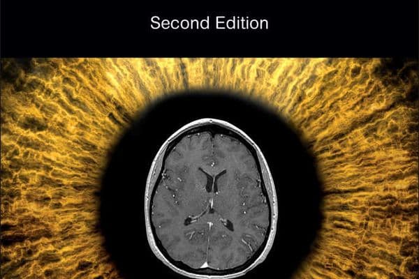 Book review – The Neuro-Ophthalmology Survival Guide, second edition