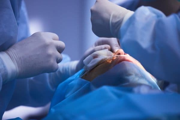 Oculoplastics: research review