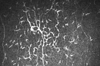 The current state of ocular surface pain and its future