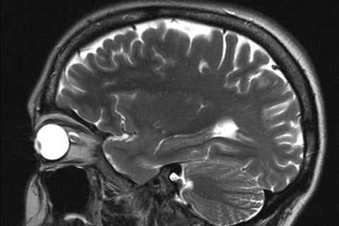 Neuroscientists say size matters