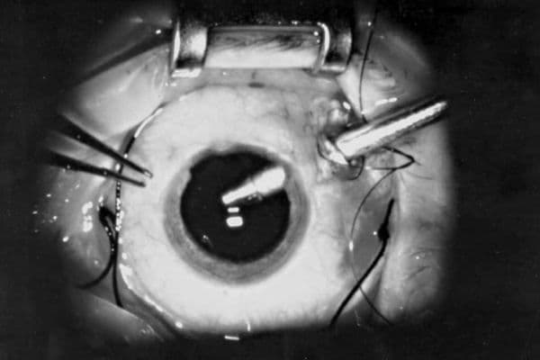 Vitreoretinal research update (1)