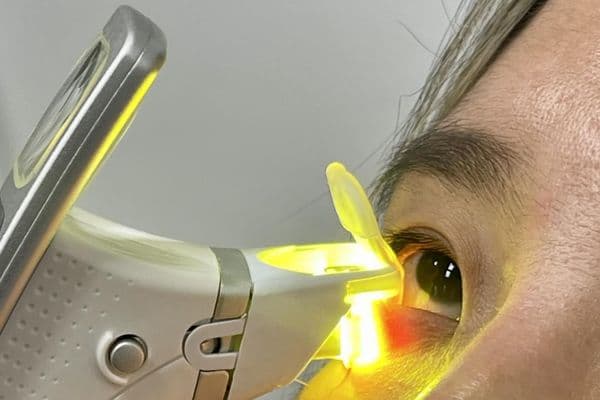 Handheld thermal pulsation promise for MGD