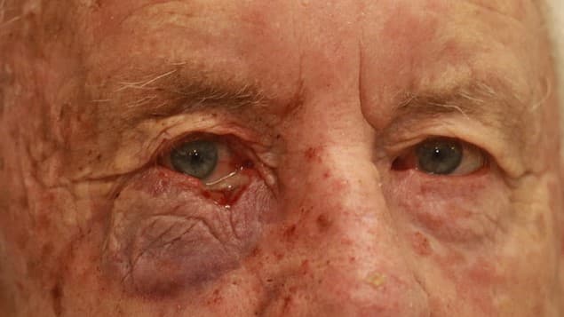 Let nature take care of it-older-man-pic-1.jpeg