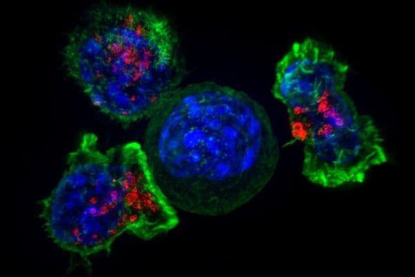 Cancer therapy’s ocular impact