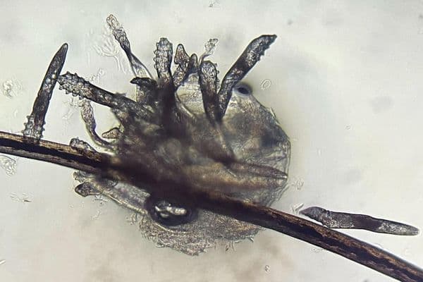 Investigating Demodex’s susceptibility to castor oil