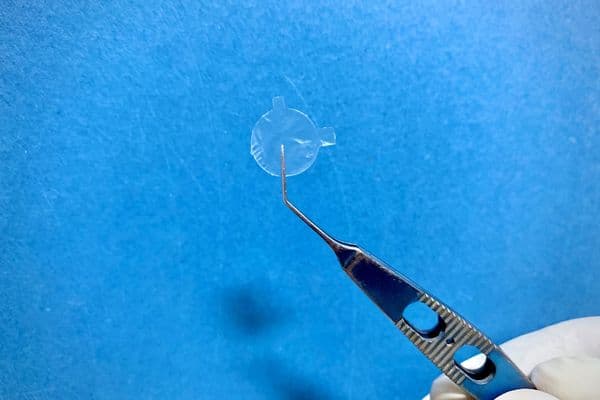 Amniotic membrane for optometrists