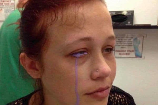 Kiwis join call to ban eyeball tattoos
