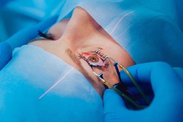 The fall and rise of refractive surgery