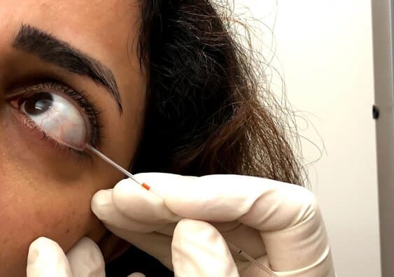 Tear test screening for diabetes complications
