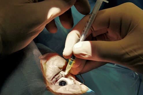 Trials advance for fewer injections