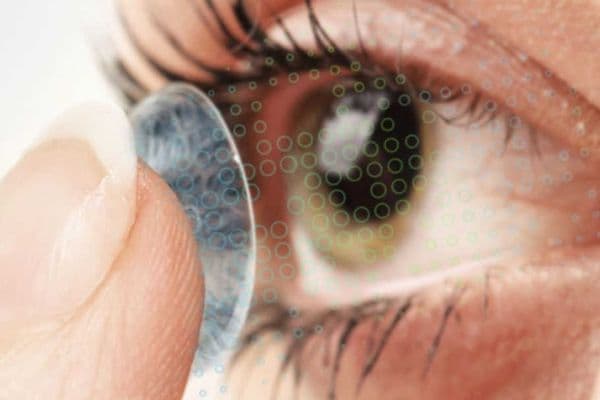 CLs for glaucoma treatment