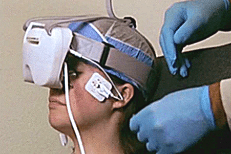 Microcurrent treatment for dry AMD?