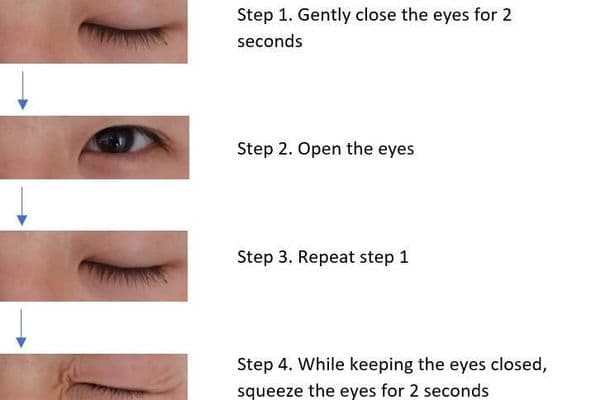 Blinking exercises can make a difference!