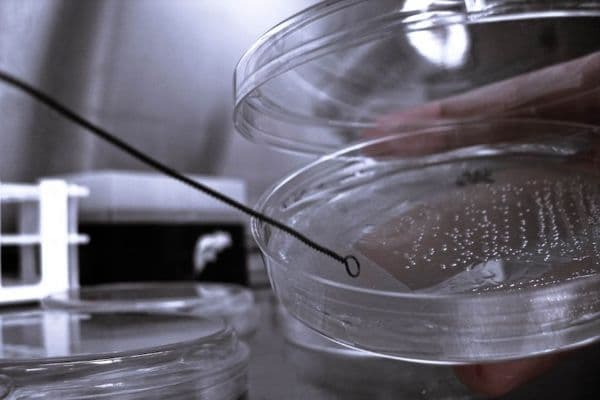 bacterial plates