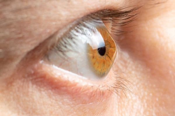 Keratoconus care – past, present and future