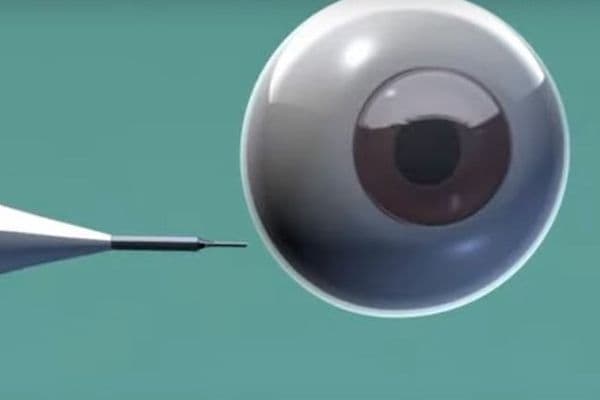 implant pic online