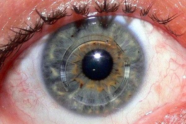 Paediatric and cornea research review