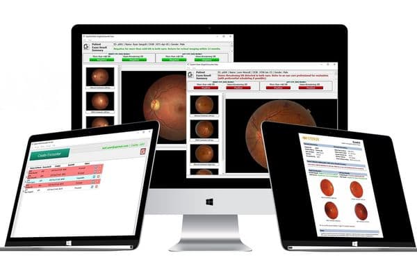 Accessible AI system for DR screening