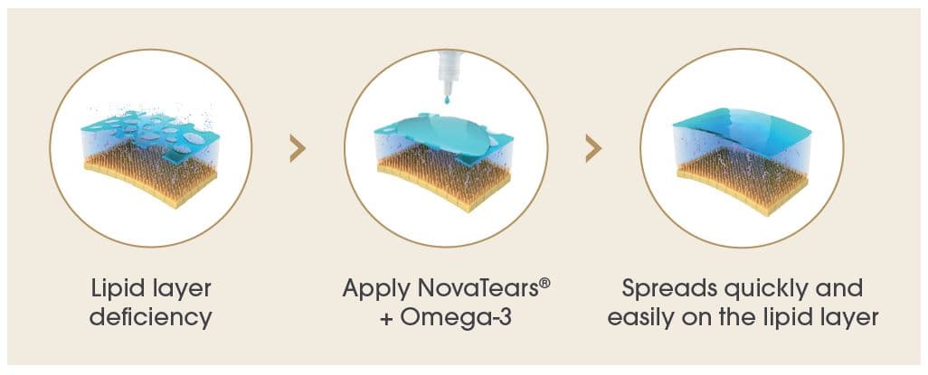 SPONSORED: Restoring equilibrium – NovaTears-aft-pic-2.jpg