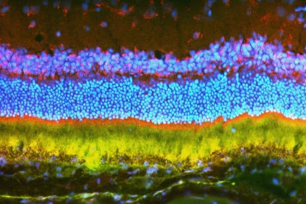 Nanoparticles: unlocking genetic eye therapy?